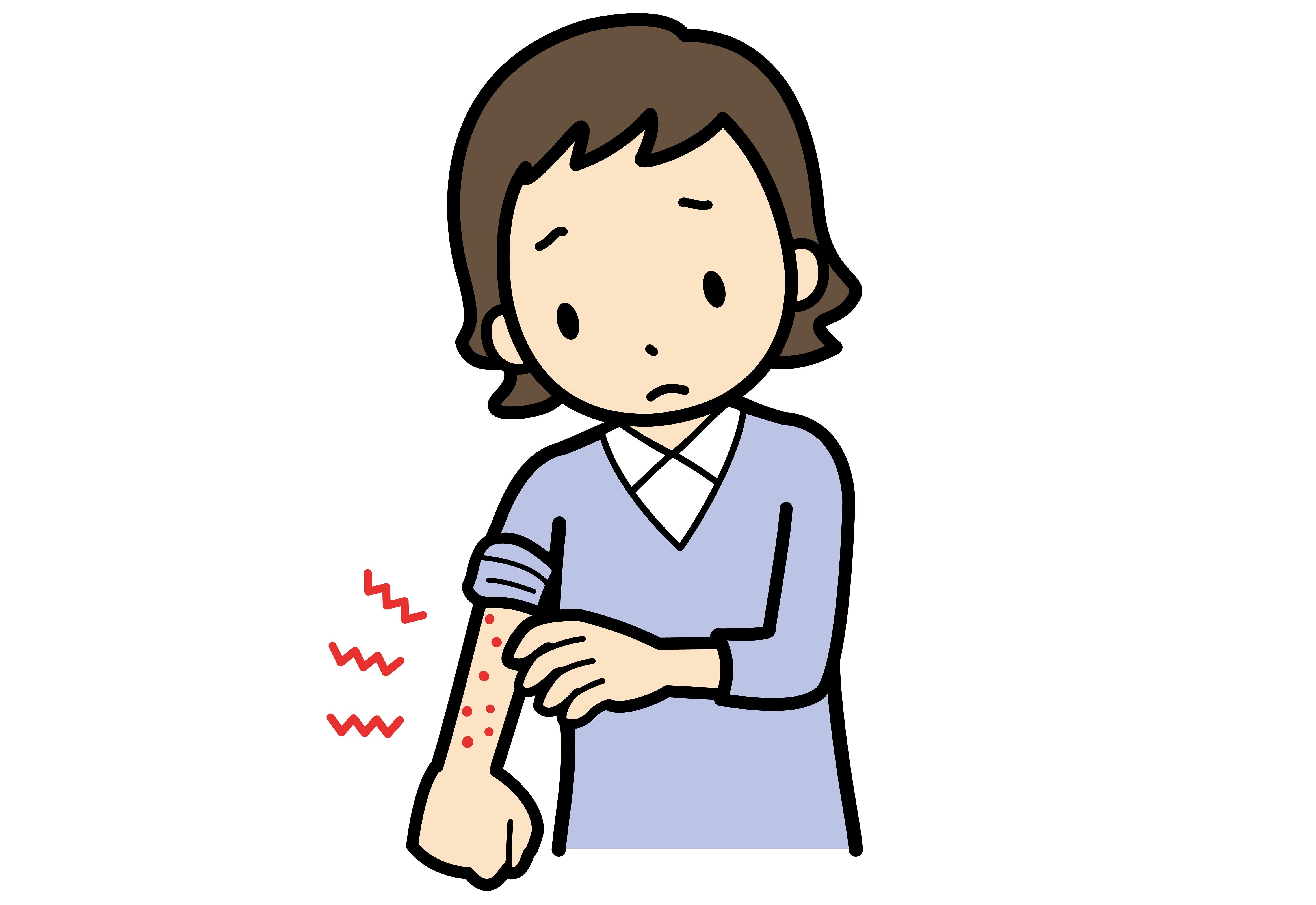 疥癬(かいせん)とは