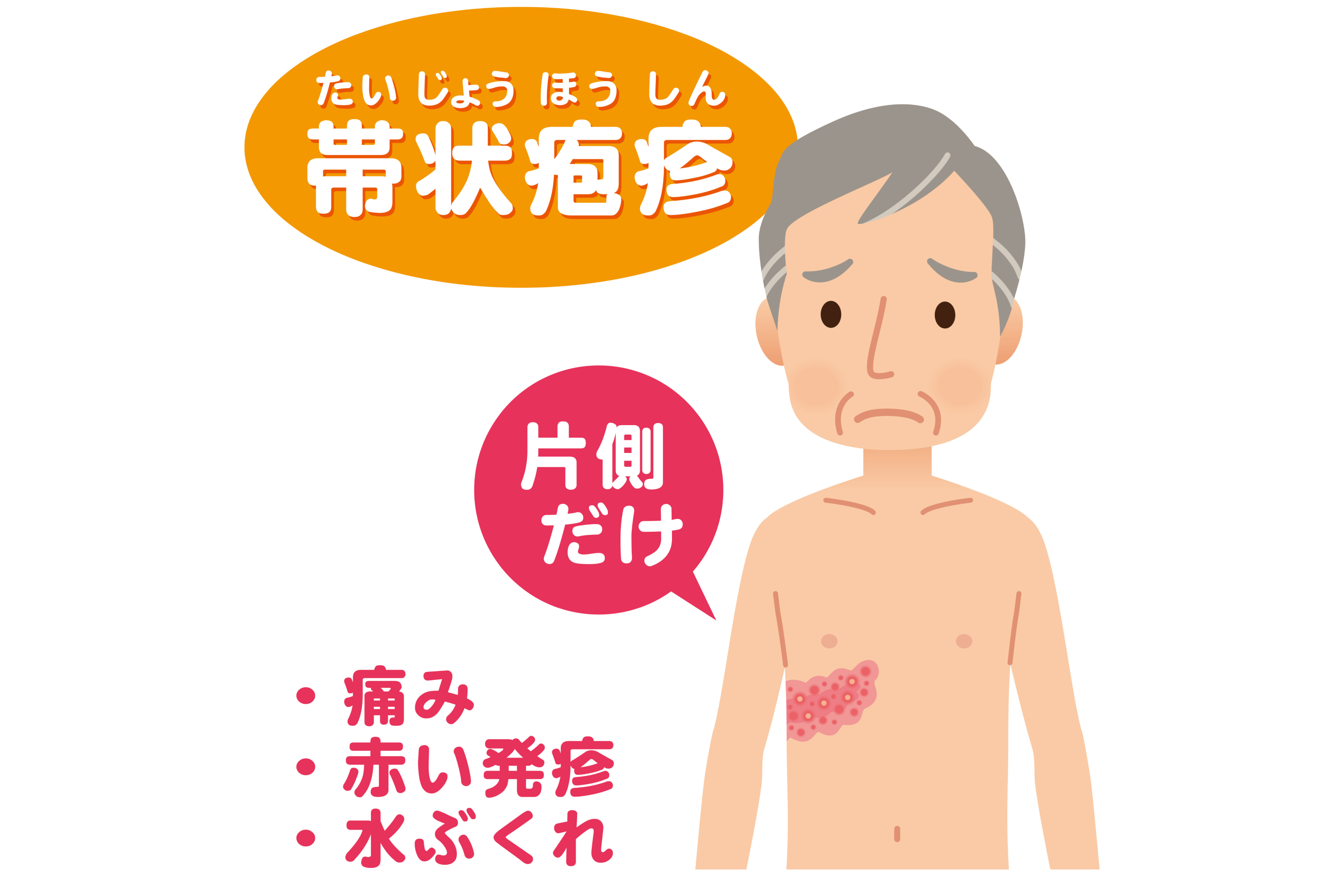 高齢の方がかかりやすい帯状疱疹（たいじょうほうしん）と合併症